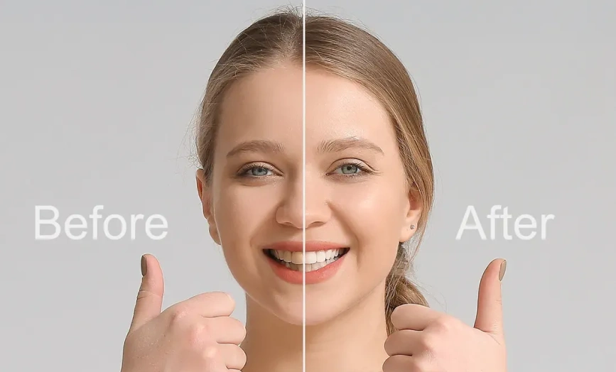 Complete Smile Makeovers for a Stunning Look