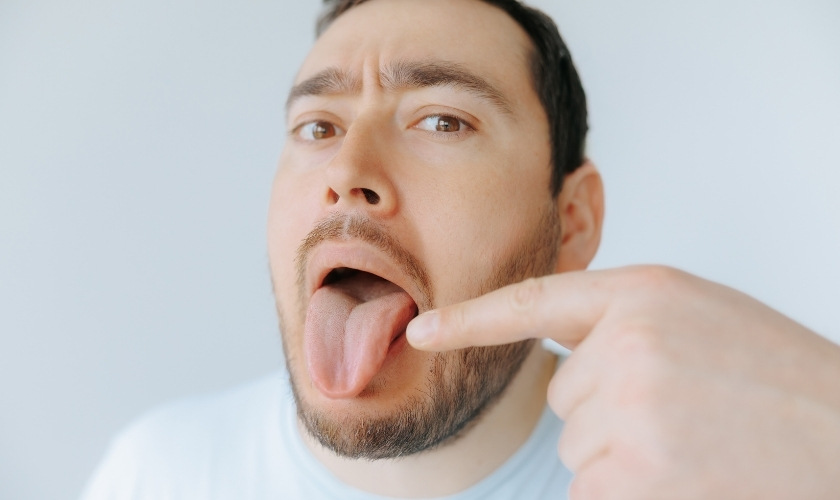 How to get rid of white tongue permanently