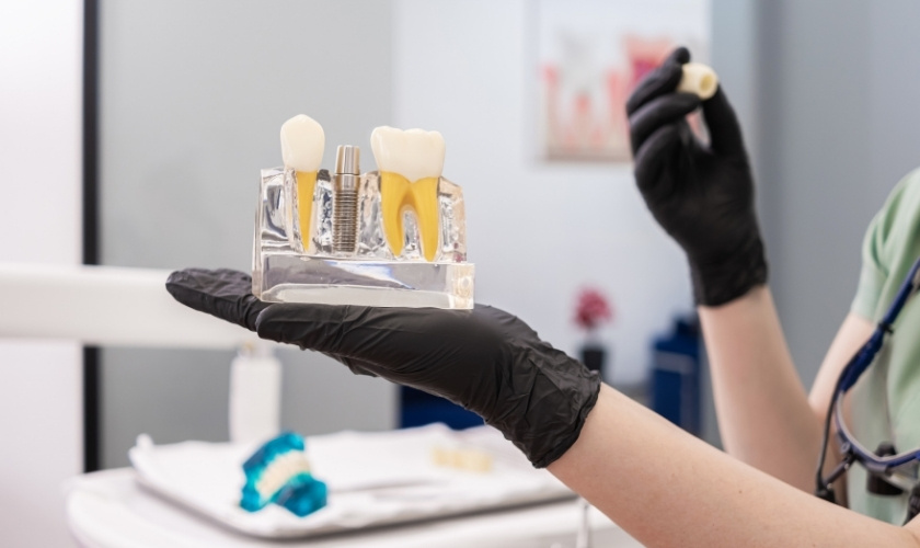 Dental Implant Process Take