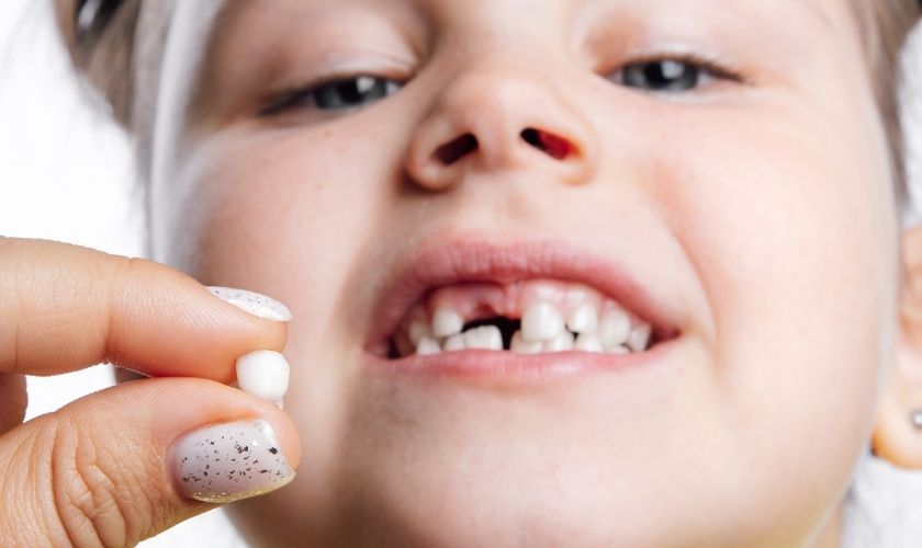 Knocked-Out Tooth